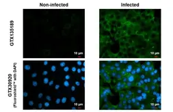 Anti-Chikungunya virus nsP3 antibody used in Immunocytochemistry/ Immunofluorescence (ICC/IF). GTX135189